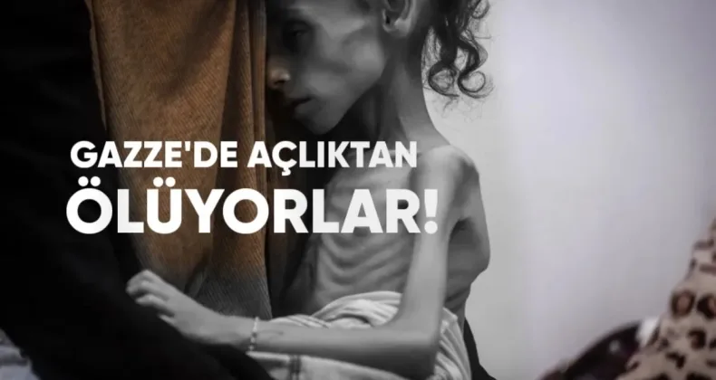 Gazze’de Açlıktan Ölenlerin Sayısı 180’e Ulaştı